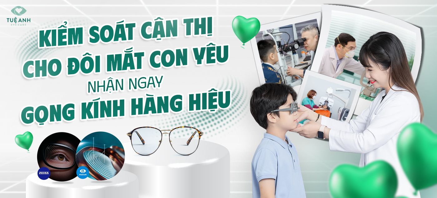 promo tròng kính kiểm soát cạn thị tháng 7