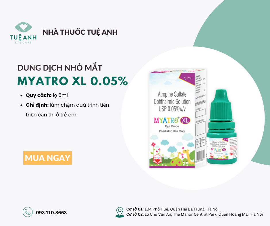 Kiểm soát cận thị Myatro XL