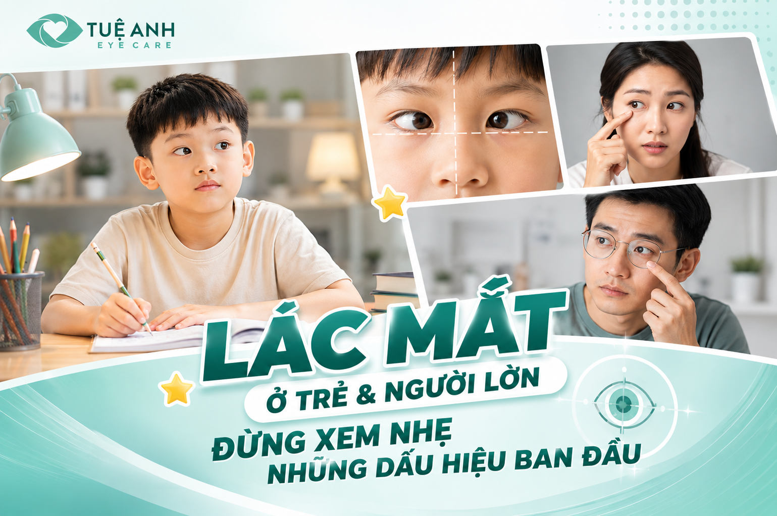 L&aacute;c mắt ở trẻ em v&agrave; người lớn