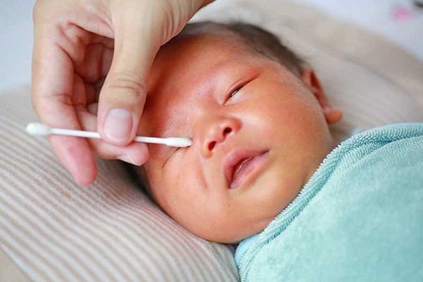 Glocom bẩm sinh có chữa được không? 