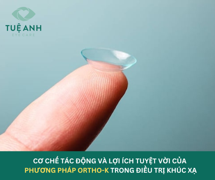 CƠ CHẾ TÁC ĐỘNG VÀ LỢI ÍCH TUYỆT VỜI CỦA PHƯƠNG PHÁP ORTHO-K TRONG ĐIỀU TRỊ KHÚC XẠ