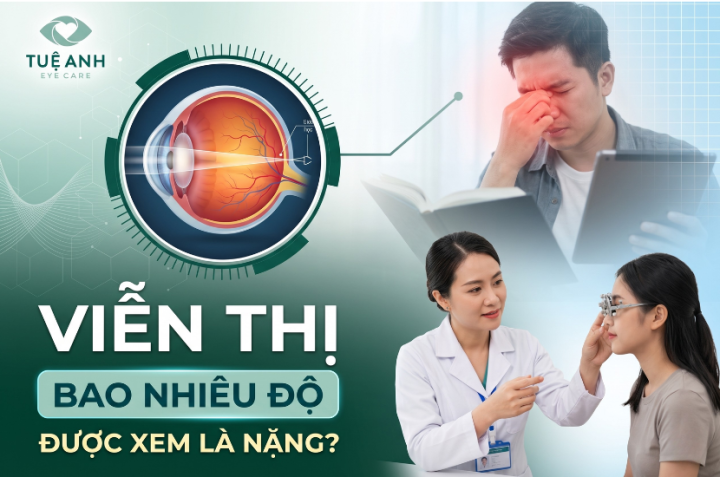 Viễn thị bao nhiêu độ là nặng và nguy hiểm