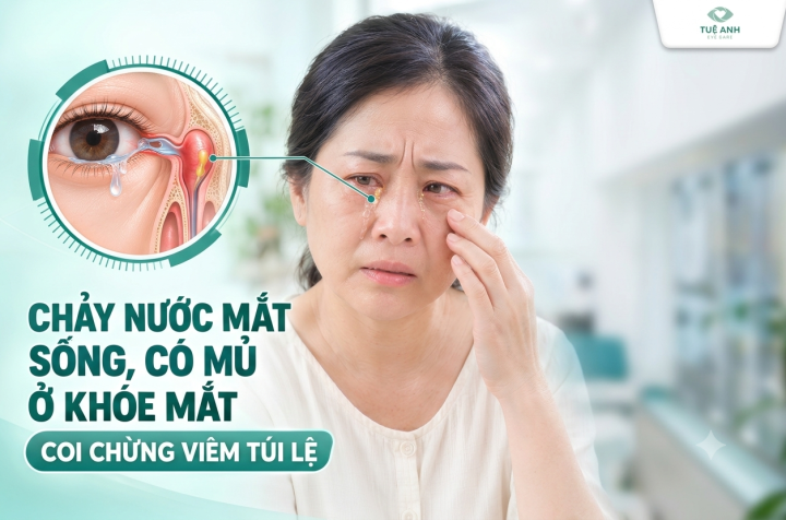 Dấu hiệu nhận biết và cách điều trị bệnh viêm túi lệ