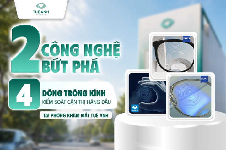2 Công nghệ bứt phá - 4 dòng tròng kính kiểm soát cận thị tại Tuệ Anh